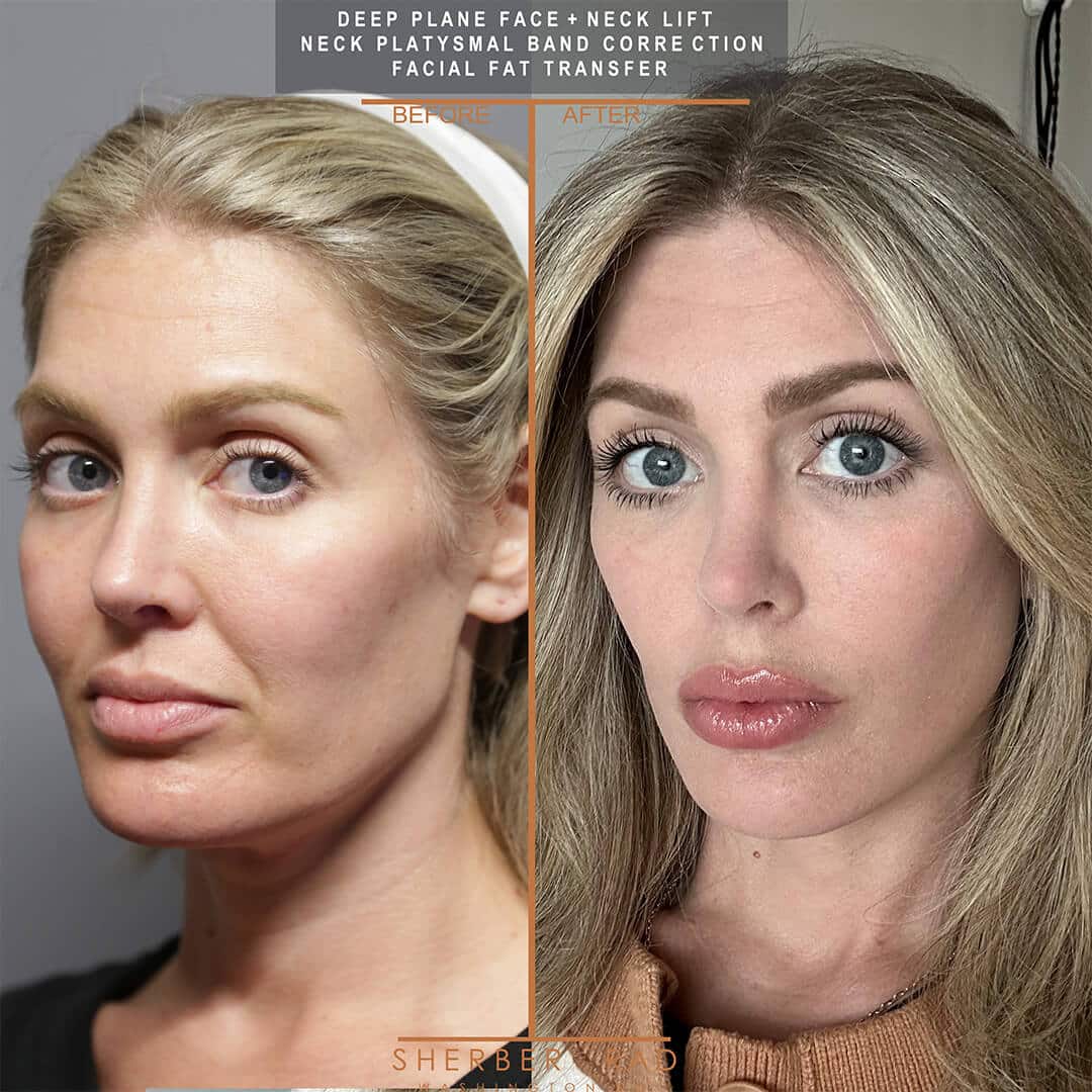 Boda De Noelle Sherber